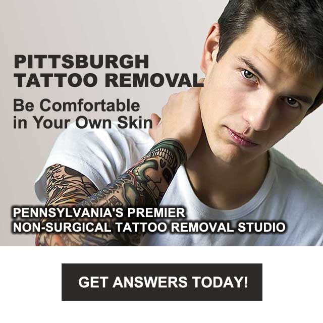 non-surgical tattoo removal pittsburgh pa
